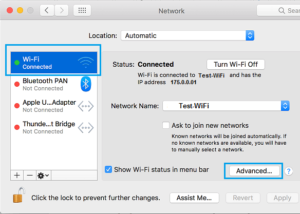 Advanced Option in Network Settings Screen on Mac